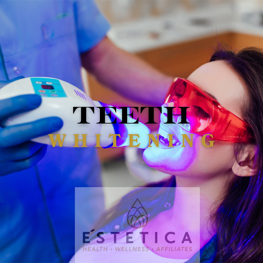 Teeth whitening
